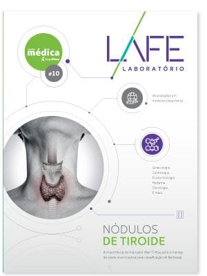 Nódulos de tireóide